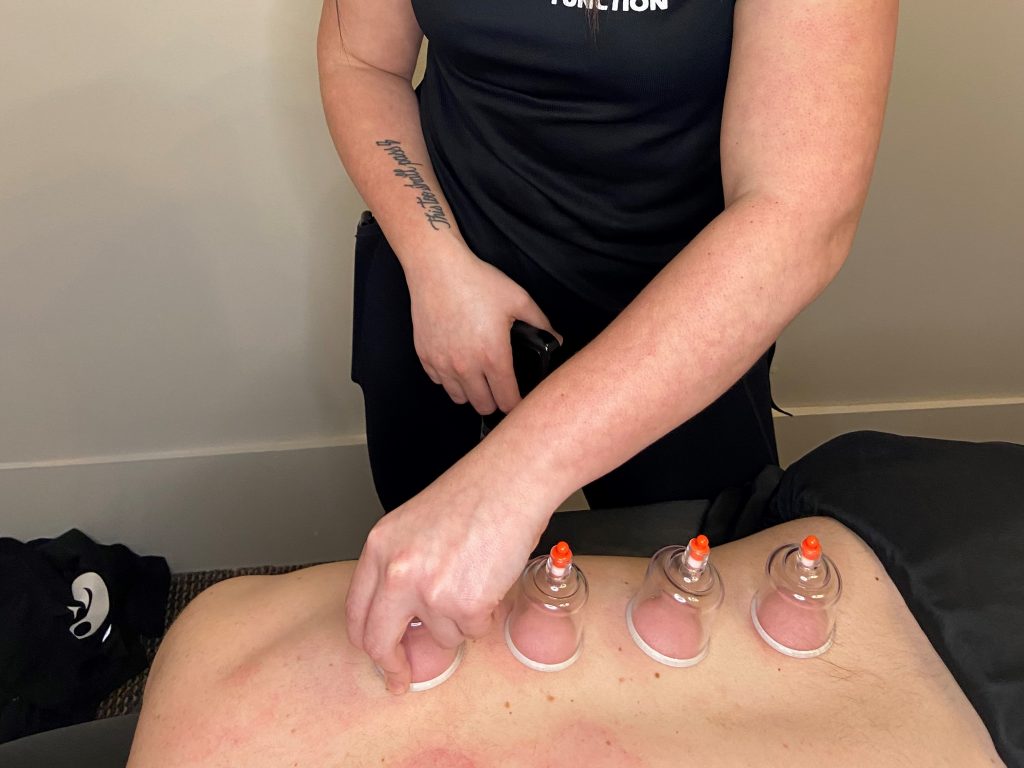 Cupping Therapy by a Registered Massage Therapist London Ontario