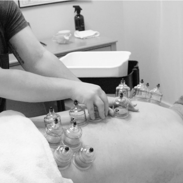 Cupping Therapy by a registered massage therapist in London Ontario