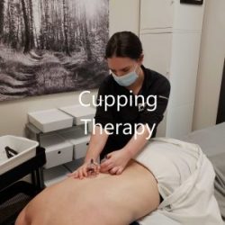 Cupping Therapy at Pro Function In London Ontario